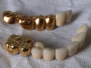 Вакуумные установки для нанесения покрытий  под золото  на зубные протезы из Беларуси